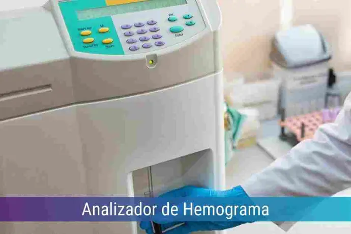 Locação de Analizador de Hemograma