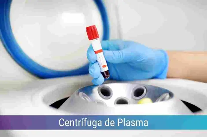 Locação de Centrífuga de Plasma