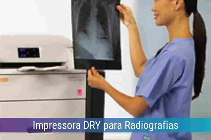 Locação de Impressora DRY para Radiografias