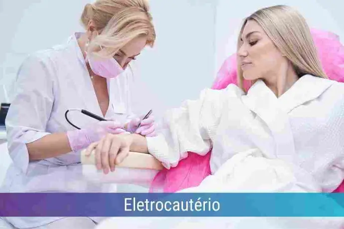 Locação de Eletrocautério