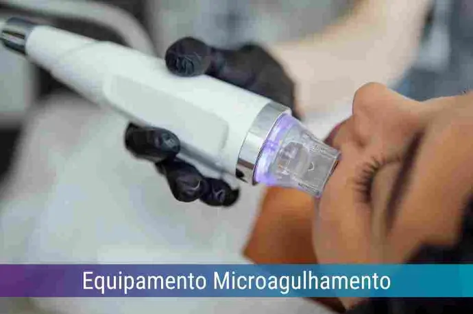 Locação de Equipamento Microagulhamento