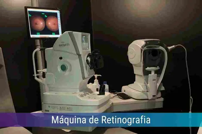 Locação de Máquina de Retinografia