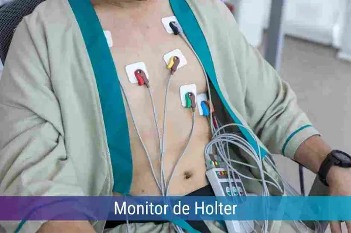 Locação de Monitor de Holter